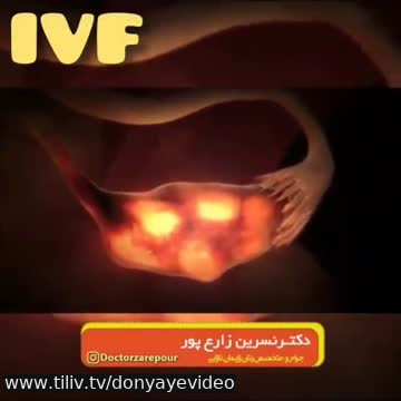 فیلم بارداری ازمایشگاهی با روش IVF